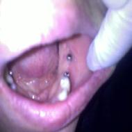 الدكتور جعفر عايش - الخليل