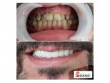 مركز الكرمل لطب الاسنان— د.اسامه يونس زلوم - 2