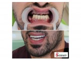 مركز الكرمل لطب الاسنان— د.اسامه يونس زلوم - 3