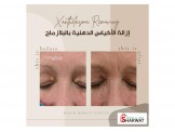 مركز زين للتجميل  - 3